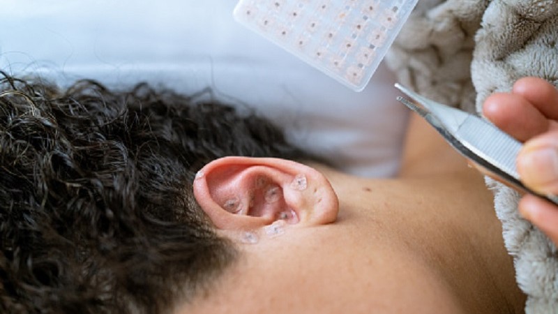 Curso auriculoterapia